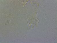 Testechiniscus laterculus image