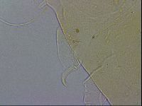 Echiniscus wendti image