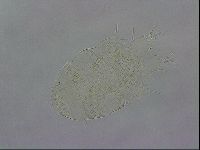 Testechiniscus laterculus image