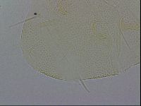Testechiniscus laterculus image