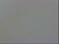 Testechiniscus laterculus image