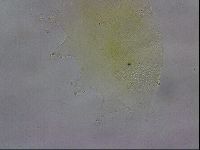 Echiniscus wendti image