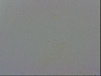 Echiniscus wendti image