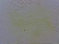 Echiniscus wendti image