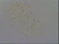 Echiniscus testudo image