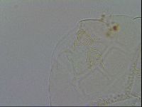 Echiniscus testudo image