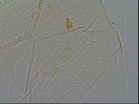 Echiniscus testudo image