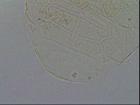 Echiniscus testudo image
