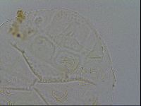 Echiniscus testudo image