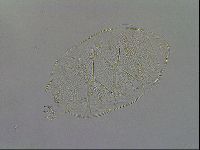 Echiniscus testudo image
