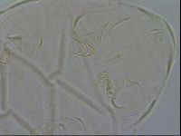 Echiniscus testudo image