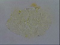 Echiniscus testudo image