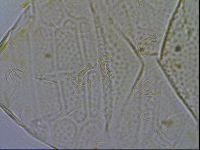 Echiniscus testudo image