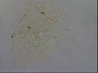Echiniscus testudo image
