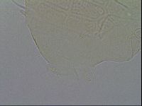 Echiniscus testudo image
