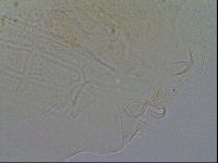 Echiniscus testudo image