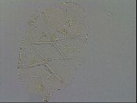 Echiniscus testudo image
