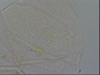 Echiniscus testudo image