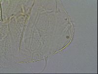 Echiniscus testudo image