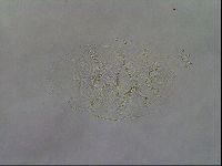 Echiniscus testudo image