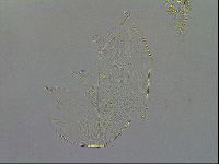 Echiniscus testudo image