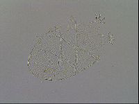 Echiniscus testudo image