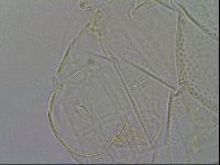 Echiniscus testudo image