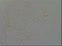 Echiniscus testudo image