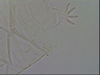 Echiniscus testudo image