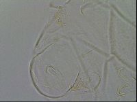 Echiniscus testudo image