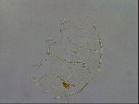 Echiniscus testudo image