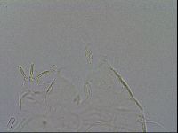Echiniscus testudo image