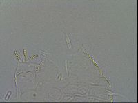 Echiniscus testudo image
