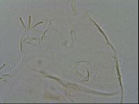 Echiniscus testudo image