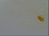 Echiniscus testudo image