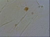 Echiniscus testudo image