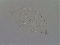 Echiniscus testudo image