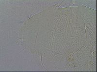 Echiniscus testudo image