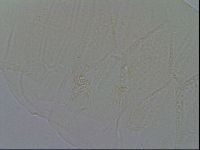 Echiniscus testudo image