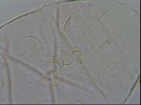 Echiniscus testudo image