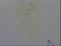 Echiniscus testudo image