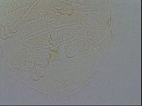 Echiniscus testudo image