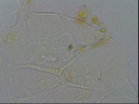 Echiniscus testudo image