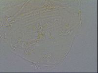 Echiniscus testudo image