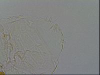 Echiniscus testudo image