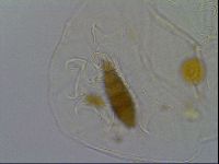 Echiniscus testudo image