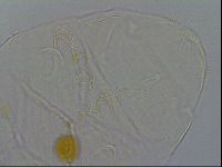 Echiniscus testudo image