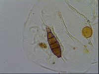 Echiniscus testudo image