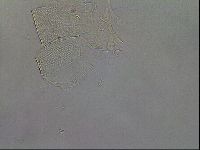 Echiniscus testudo image