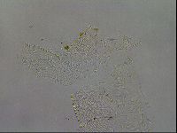 Echiniscus testudo image